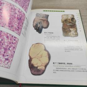 病理解剖学彩色图谱——医学教学图谱系列