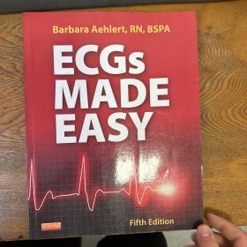 ECGs MADE EASY