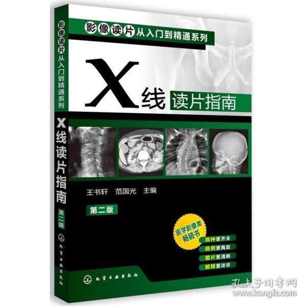 影像读片从入门到精通系列：X线读片指南（第2版）