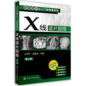 影像读片从入门到精通系列：X线读片指南（第2版）