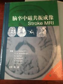 脑卒中磁共振成像Stroke MRI