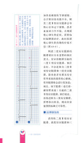 危急重症心电图快手