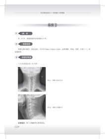 积水潭放读片