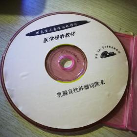 乳腺良性肿瘤切除术VCD