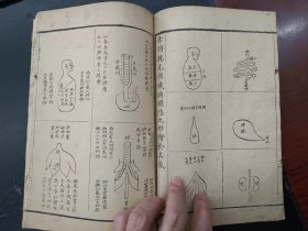 《医林改错》京都隆福寺三槐堂本（上下册）