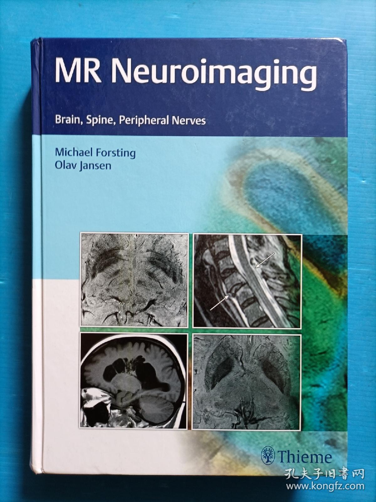 MR Neuroimaging
   Brain,Spine,Peripheral Nerves
  （脑、脊柱、外周神经的MR神经成像）