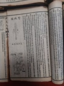 《增补绘图针灸大成》民国石印版本，共十二卷6本全，完整的一套全。保存品相完整，包老包真！