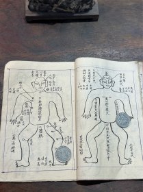 手写本《治损伤总论》，大量绘图