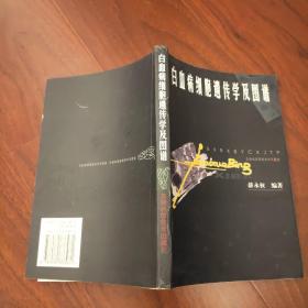 白血病细胞遗传学及图谱