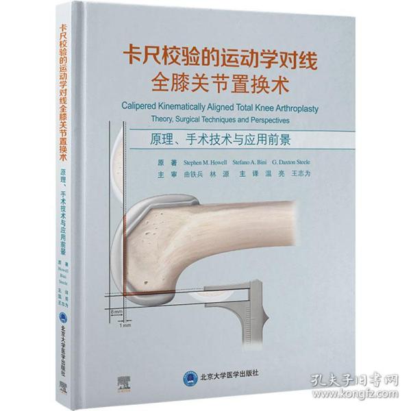 卡尺校验的运动学对线全膝关节置换术——原理、手术技术与应用前景