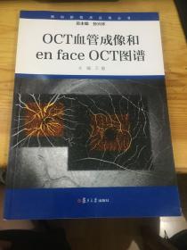 眼科新技术应用丛书：OCT血管成像和enface OCT图谱（平装版）
