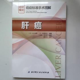 肝癌癌症标准手术图解 日山口俊晴，日斋浦明夫 著 丁光辉项灿宏 译