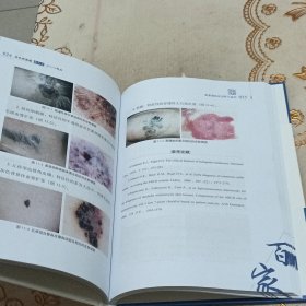 恶性黑素瘤高天文2019观点/中国医学临床百家