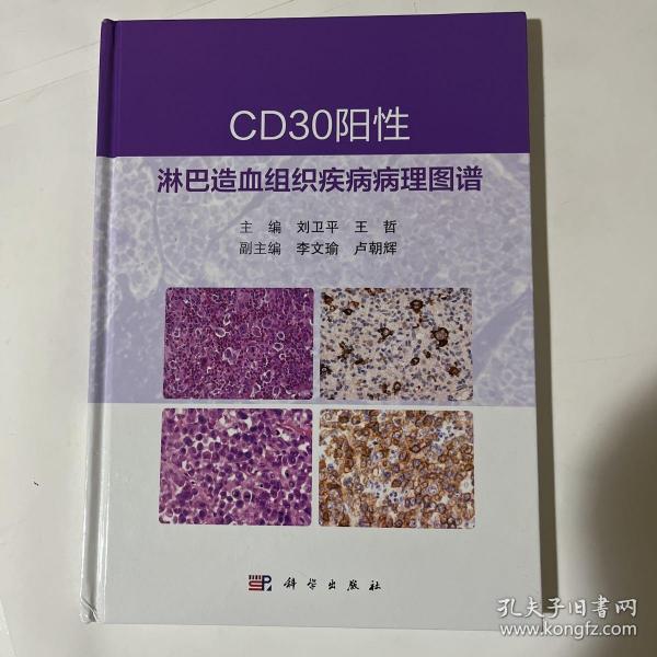 CD30阳性淋巴造血组织疾病病理图谱 刘卫平 王哲著