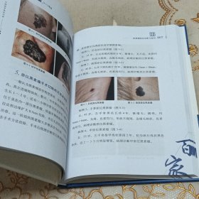 恶性黑素瘤高天文2019观点/中国医学临床百家