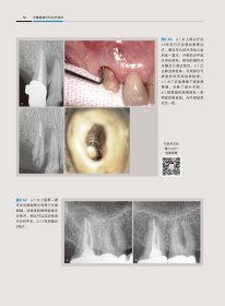 牙髓显微外科治疗技术 （意）阿纳尔多·卡斯泰卢奇（Arnaldo Castellucci）主编 阙克华，屈铁军主译 正版图书