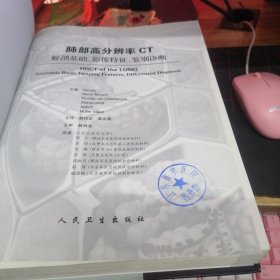 肺部高分辨率CT