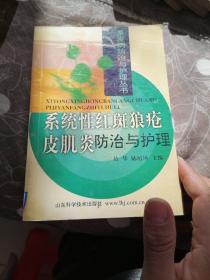 多发病防治与护理丛书 系统性红斑狼疮皮肌炎防治与护理