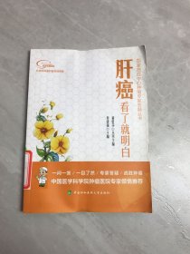 肝癌看了就明白