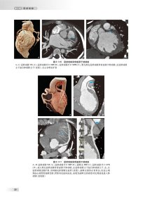 中华影像鉴别诊断学——心血管分册
