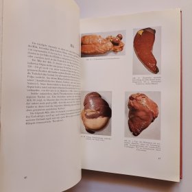 Atlas Der Pathologischen Anatomie : Eine Sammlung Typischer Krankheitsbilder Der Menschlichen Organe 病理解剖学