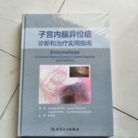 子宫内膜异位症诊断和治疗实用指南