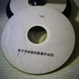 骨关节疾病的影像学诊断VCD