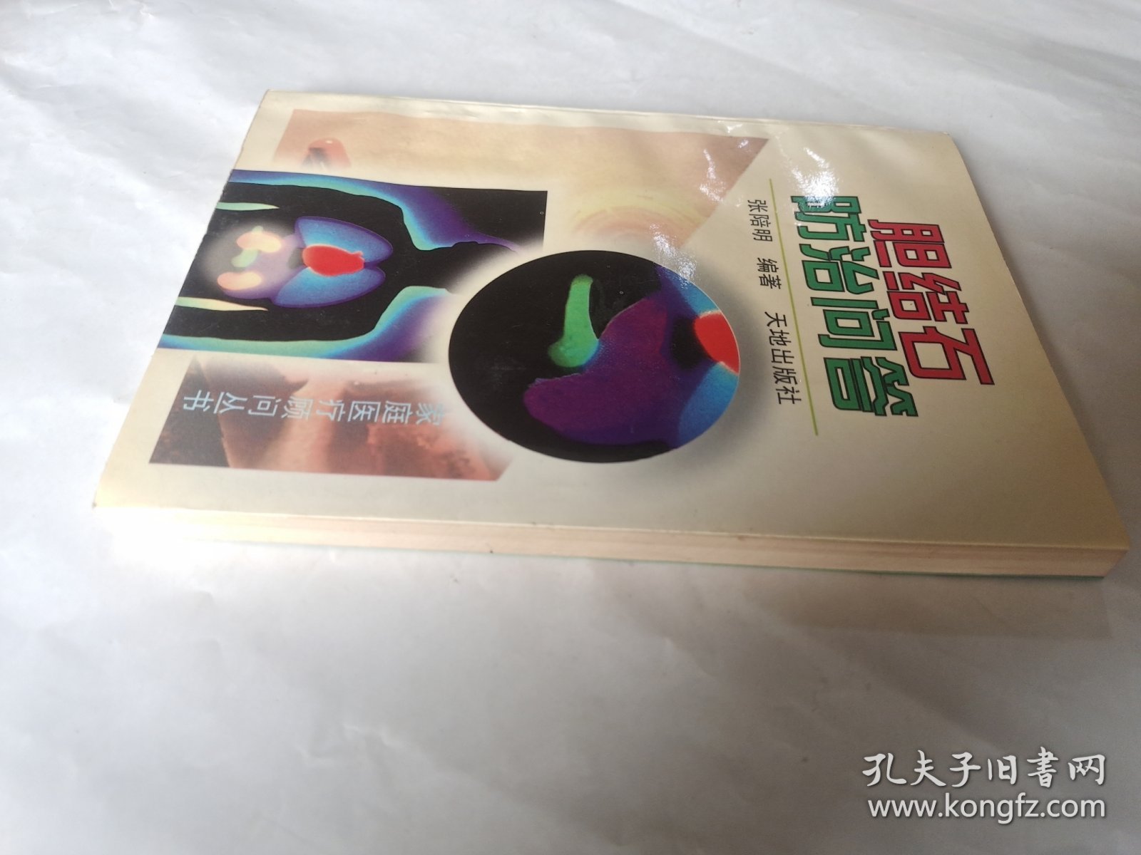 胆结石防治问答