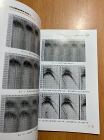 可控震源地震勘探采集技术