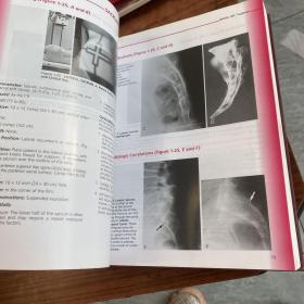 原版英文 Essentials of Skeletal Radiology 医学骨骼放射书（精装 厚册）