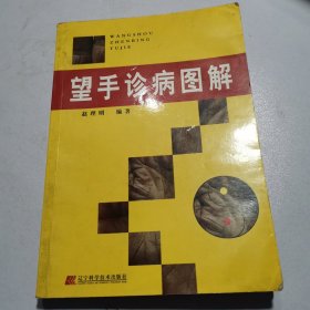 望手诊病图解