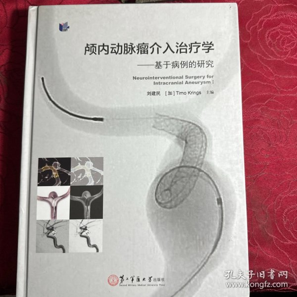 颅内动脉瘤介入治疗学：基于病例的研究