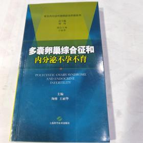 多囊卵巢综合征和内分泌不孕不育