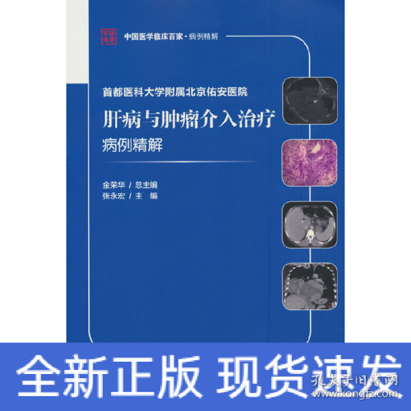 首都医科大学附属北京佑安医院肝病与肿瘤介入治疗病例精解