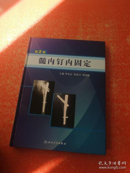 髓内钉内固定（第2版）