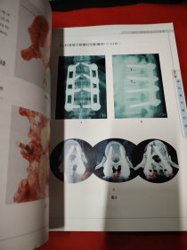 脊柱内固定系统应用指南