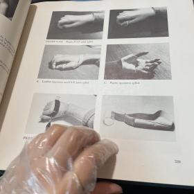 四肢瘫痪患者的物理治疗 病人第二版