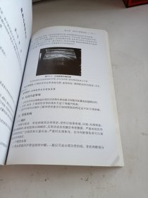 北京协和医院医疗诊疗常规·超声诊断科诊疗常规(第2版)