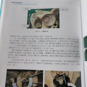 保证正版特价绝版好书！《实用骨科导航技术》品相好， 第2版 精装大16开，293页，印刷精美； 全铜版纸印。主编周东生。品相好，新书库存，塑封全新包装外皮九九品几乎全新，里面干净无翻阅。定价200元。人民军医出版社，值得阅读学习收藏！包好二斤多重！市场价格100元一本以上。