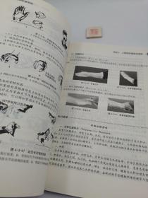 上肢矫形器装配(一版一印)