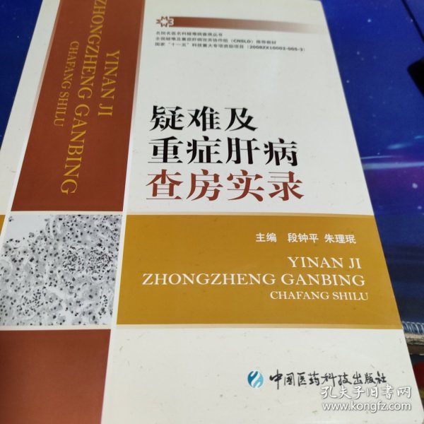 疑难及重症肝病查房实录