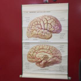 印刷品-医学教学图谱挂图（卷轴装裱、中英文）——Ⅵ-25 大脑半球的动脉【22】折痕、背面脏