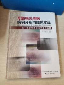 牙髓根尖周病病例分析与临床实战：基于根管形态的治疗疾病策略选择