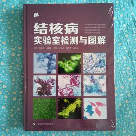 结核病实验室检测与图解