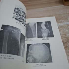 临床骨科学 肿瘤3