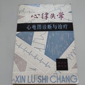 心律失常心电图诊断与治疗