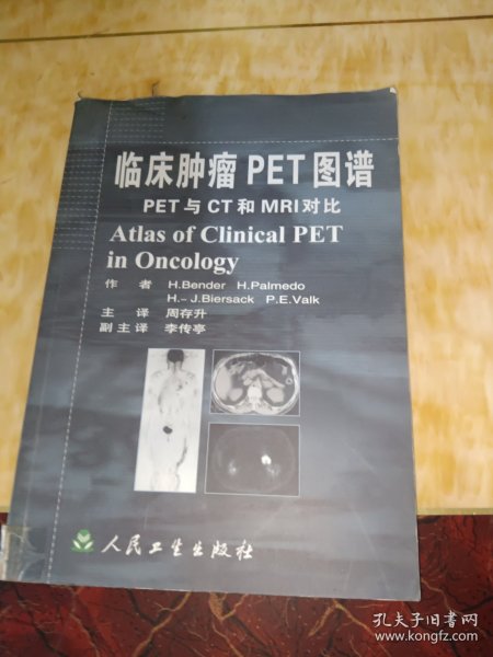 临床肿瘤PET图谱：PET与CT和MRI对比