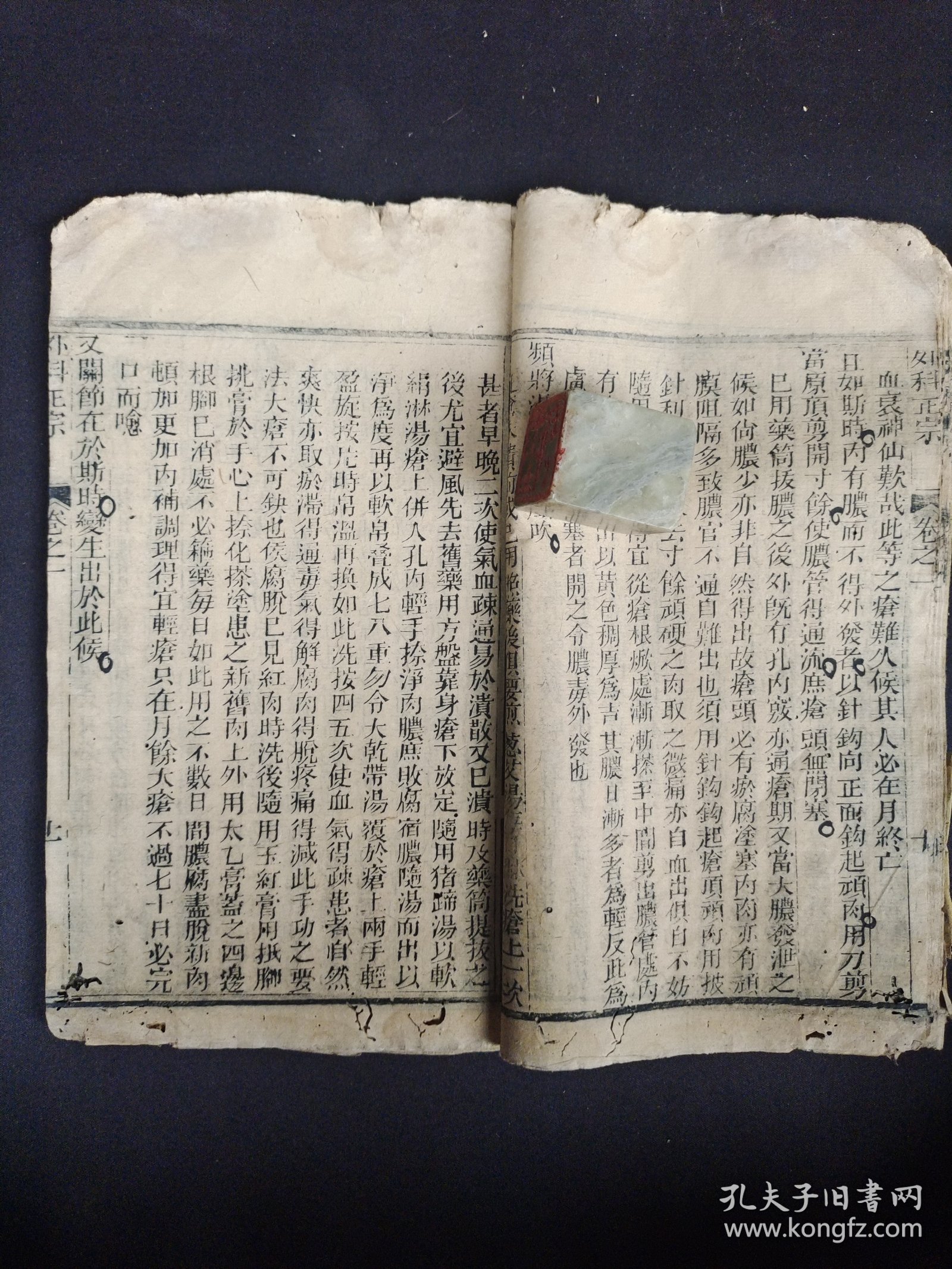 《外科正宗》卷一，清代木刻本。