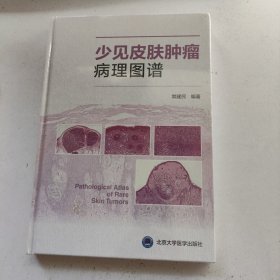 少见皮肤肿瘤病理图谱