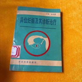 异位妊娠及其诊断治疗